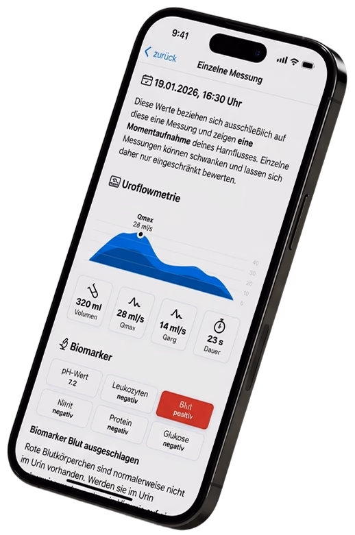 Streamcheck app with uroflowmetry curve